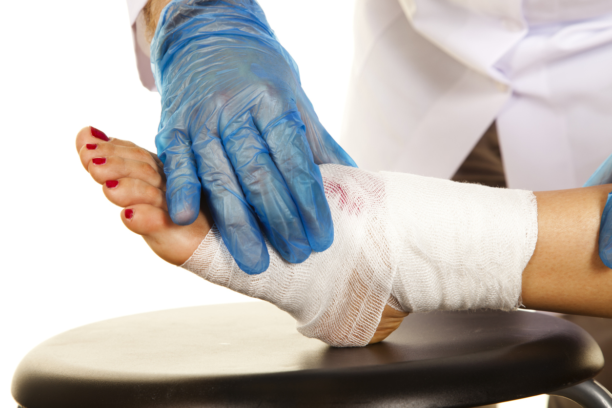 Orthopedic Treatment for Diabetic Foot Ulcers Effective Strategies and Management