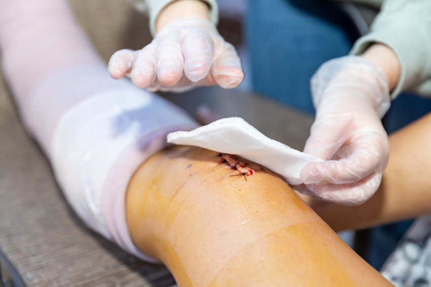 Orthopedic Treatment for Non-Healing Wounds