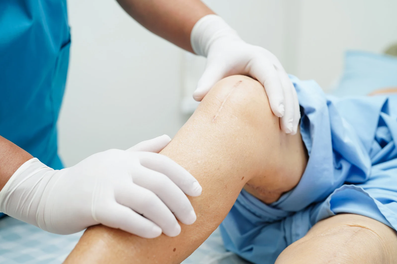 Affordable Knee Surgery Your Complete Guide to Options, Costs, and Recovery
