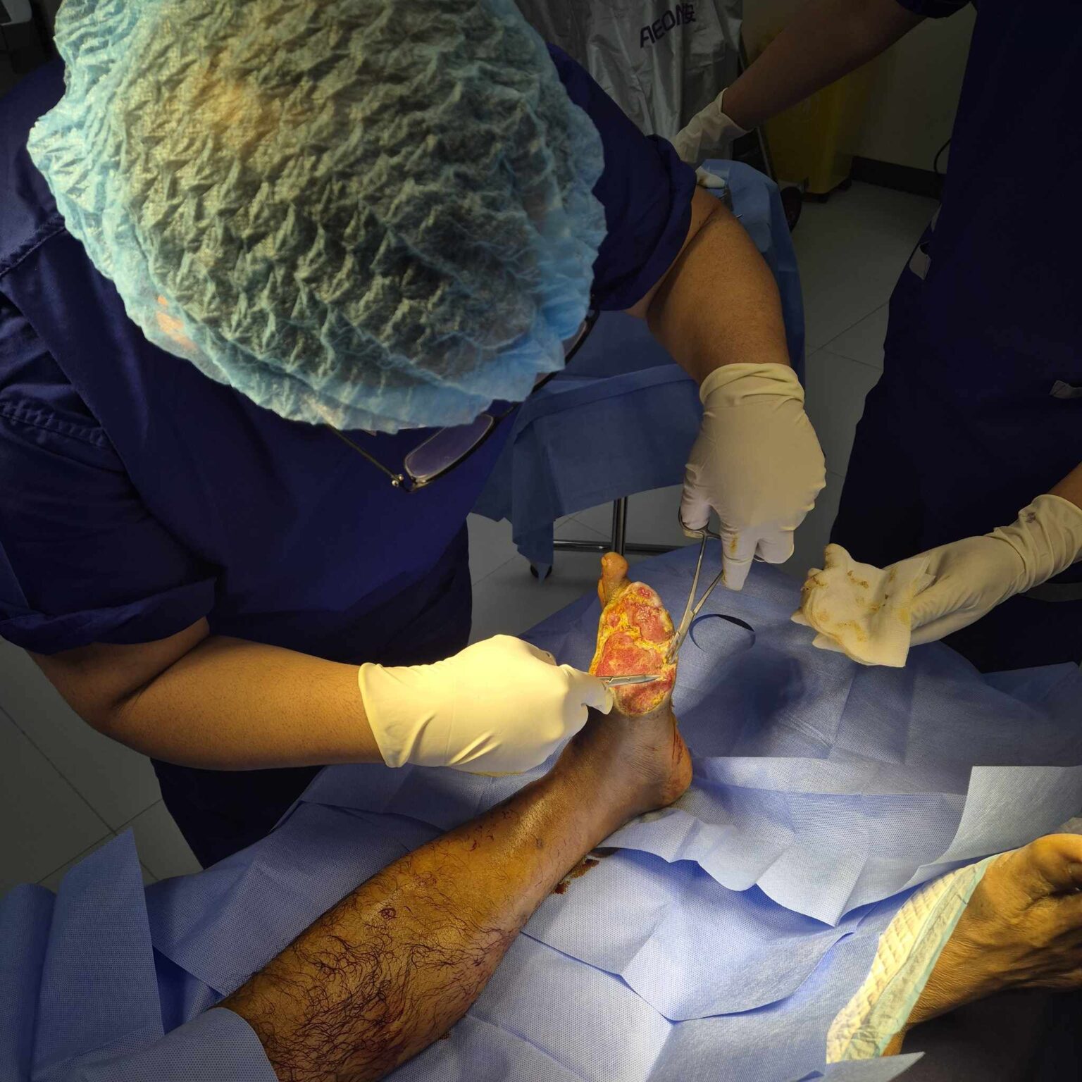 Why You Need a Wound Care Doctor for Chronic or Infected Wounds ...