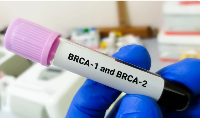 BRCA Genetic Test Philippines